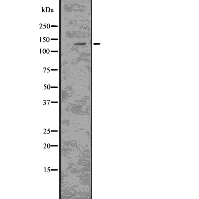 Polyclonal Rabbit anti-Human CSF2RB / CD131 Antibody (IF, WB)