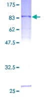 Human SERPING1 / C1 Inhibitor Protein (Recombinant GST)