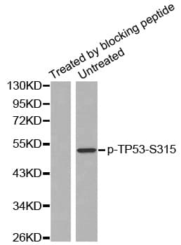 TP53 / p53 Antibody (phospho-Ser315)