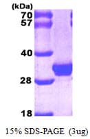Human LGALS3 / Galectin 3 Protein (Recombinant His)