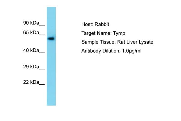 Polyclonal Rabbit anti-Rat TP / Thymidine Phosphorylase Antibody (aa89-138, WB)