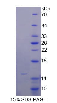 Chicken Osteocalcin Protein (Recombinant His-T7)