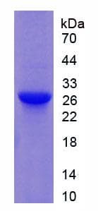 Rat GSTM1 Protein (Recombinant His, N-Terminal)