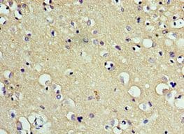 CD200R1 / CD200R Antibody (aa226-325)