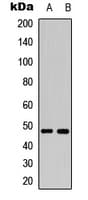 MAP2K7 / MEK7 Antibody (phospho-Ser271)