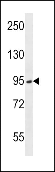 TMPRSS15 / Enterokinase Antibody (aa964-994)