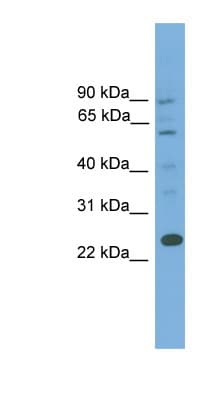 BCL7A Antibody (aa107-156)