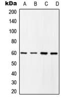 Polyclonal Rabbit anti-Human SRC Antibody (phospho-Tyr419, WB)