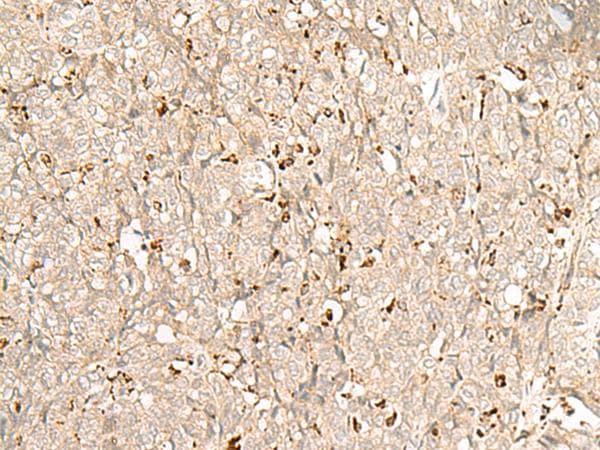 Polyclonal Rabbit anti-Human NUP210 / gp210 Antibody (IHC)