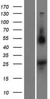 Human NOTO Protein (Over-Expression Lysate Myc-DDK (Flag))