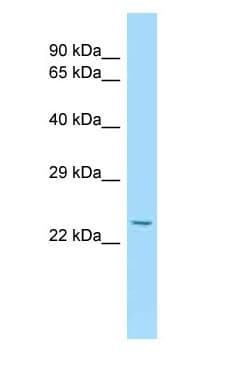 IL15RA Antibody (aa51-100)