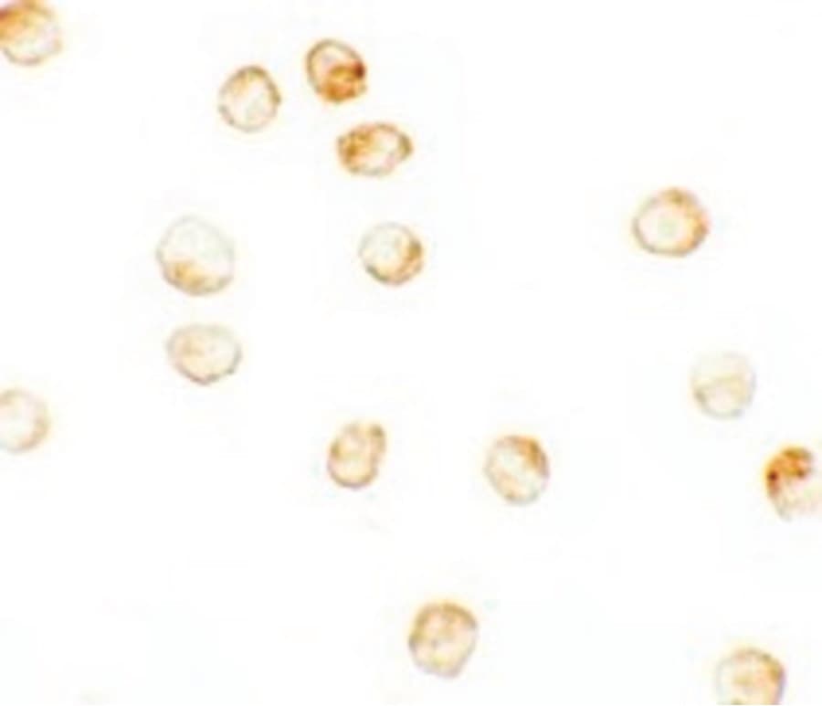 Polyclonal Rabbit anti-Human KDM6B / JMJD3 Antibody (IF, WB)