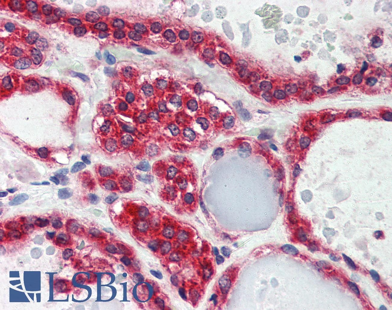 IHC-plus™ Polyclonal Goat anti-Human LPIN3 / Lipin-3 Antibody (aa149-160, IHC)