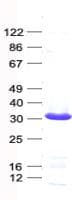 Human UBE2E3 Protein (Recombinant His, N-Terminal)