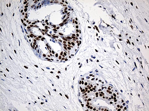 HNRNPH1 / hnRNP H Antibody (clone OTI5D11)