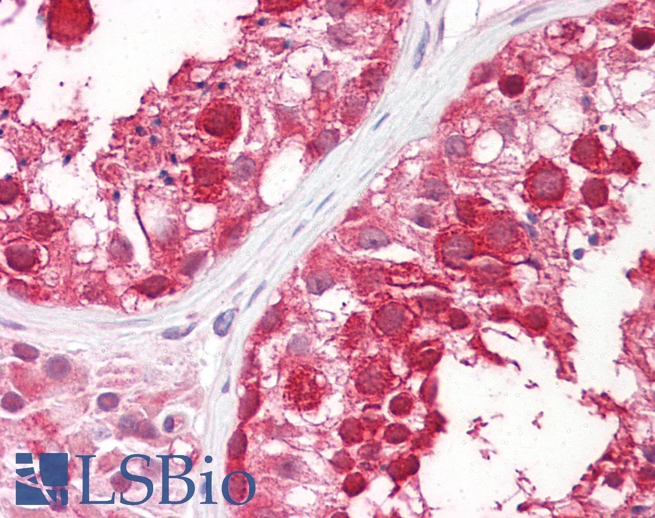 IHC-plus™ DDX4 / VASA Antibody (aa700-724)
