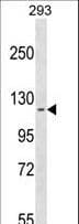 CFAP58 / CCDC147 Antibody (aa16-45)