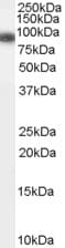 GSN / Gelsolin Antibody (aa615-626)
