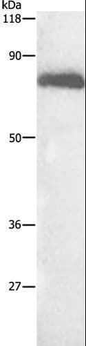 ALB / Serum Albumin Antibody