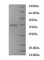 Human FCGRT / FCRN Protein (Recombinant 6His, N-terminus)