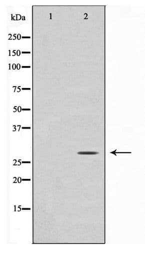 Polyclonal Rabbit anti-Human DDIT3 / CHOP Antibody (IHC, IF, WB)