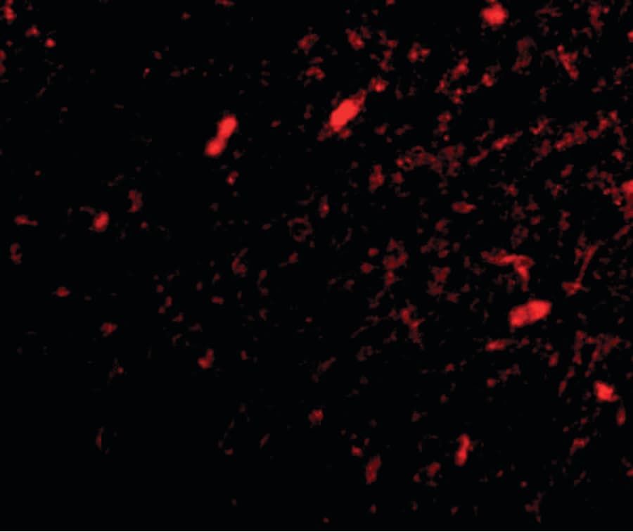 FBXL20 Antibody