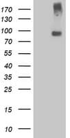 GPR49 / LGR5 Antibody (aa250-550, clone OTI3E11)