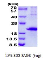 Human HAVCR2 / TIM-3 Protein (Recombinant His, N-Terminal)