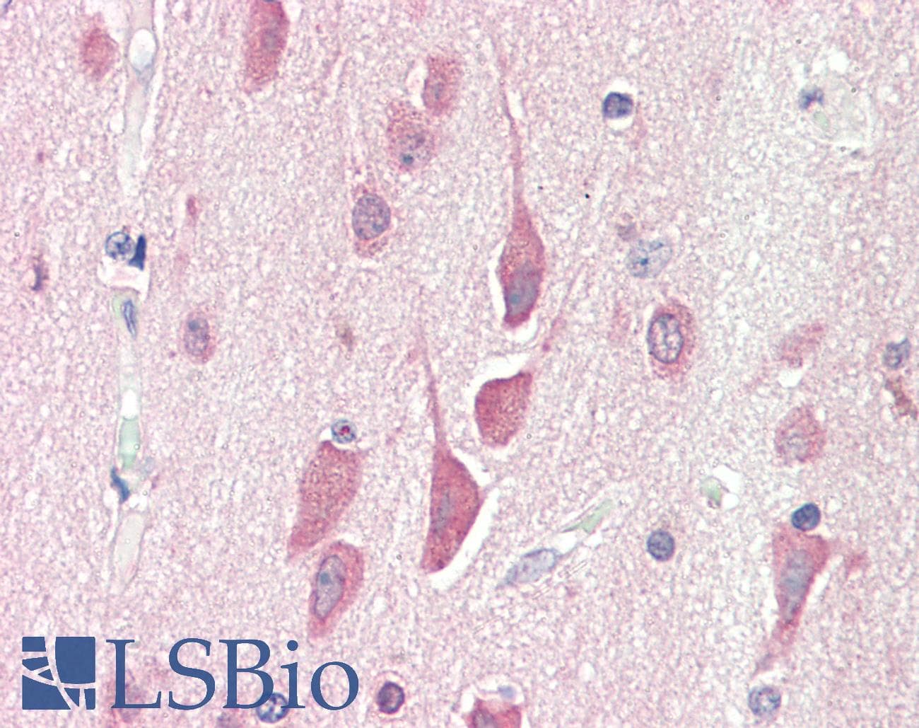IHC-plus™ HPS6 Antibody (aa455-466)
