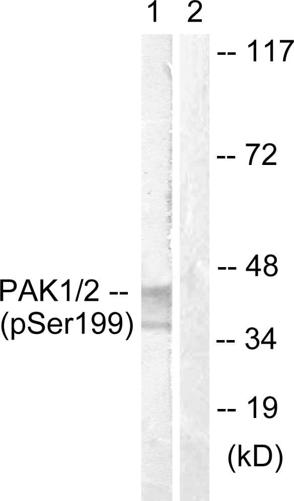 TERT / Telomerase Antibody (phospho-Ser824)