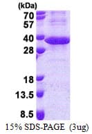 Human LRG1 / LRG Protein (Recombinant His)