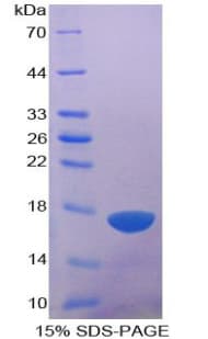 Human ADAMTS1 Protein (Recombinant His)