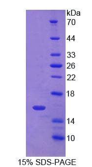 Human CD7 Protein (Recombinant His-T7)