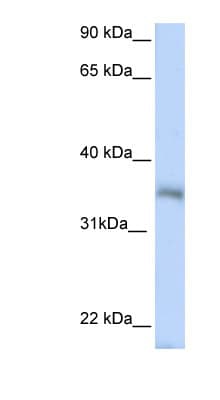 Polyclonal Rabbit anti-Human HEXIM2 Antibody (N-Terminus, WB)
