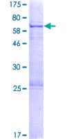 Human NANOG Protein (Recombinant GST, N-terminus)