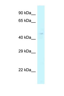 YKL39 / CHI3L2 Antibody (aa140-189)