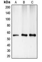 Polyclonal Rabbit anti-Human CHEK1 / CHK1 Antibody (Internal, IHC, IF, WB)