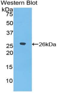 DSPG3 / Epiphycan Antibody (aa110-317)