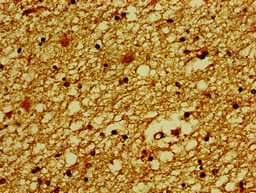 SLC30A3 / ZNT3 Antibody