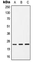 Polyclonal Rabbit anti-Human CD9 Antibody (Internal, WB)