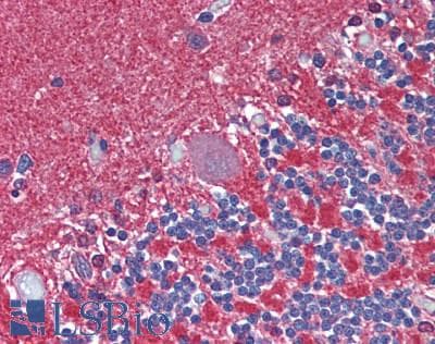 IHC-plus™ GCK / Glucokinase Antibody (aa1-300)
