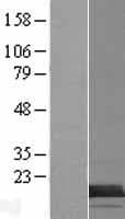 TMEM218 Protein (Over-Expression Lysate Myc-DDK (Flag))