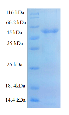 Human ADAMTS7 Protein (Recombinant 6His-SUMO, N-terminus)