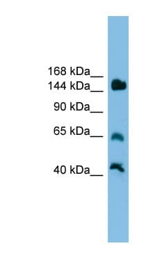 JARID2 / JMJ Antibody (aa201-250)