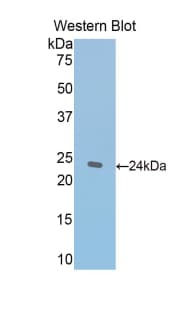 Polyclonal Rabbit anti-Mouse THBS1 / Thrombospondin-1 Antibody (aa61-259, WB)
