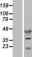 C17orf75 Protein (Over-Expression Lysate Myc-DDK (Flag))