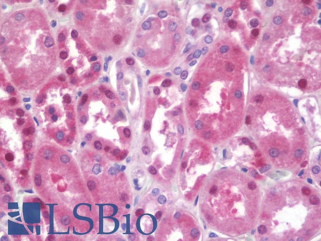IHC-plus™ SFT2D2 Antibody (aa61-110)