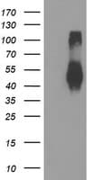 TMEFF2 Antibody (clone OTI1E4)