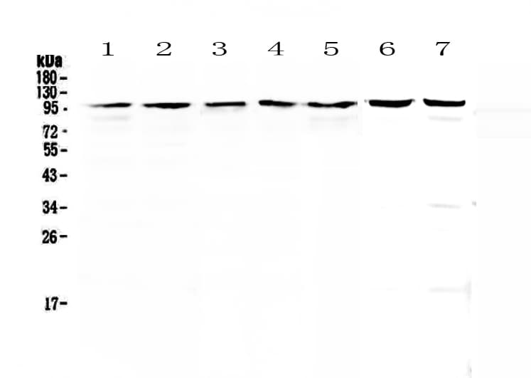 Polyclonal Rabbit anti-Human TOP1 / Topoisomerase I Antibody (WB)