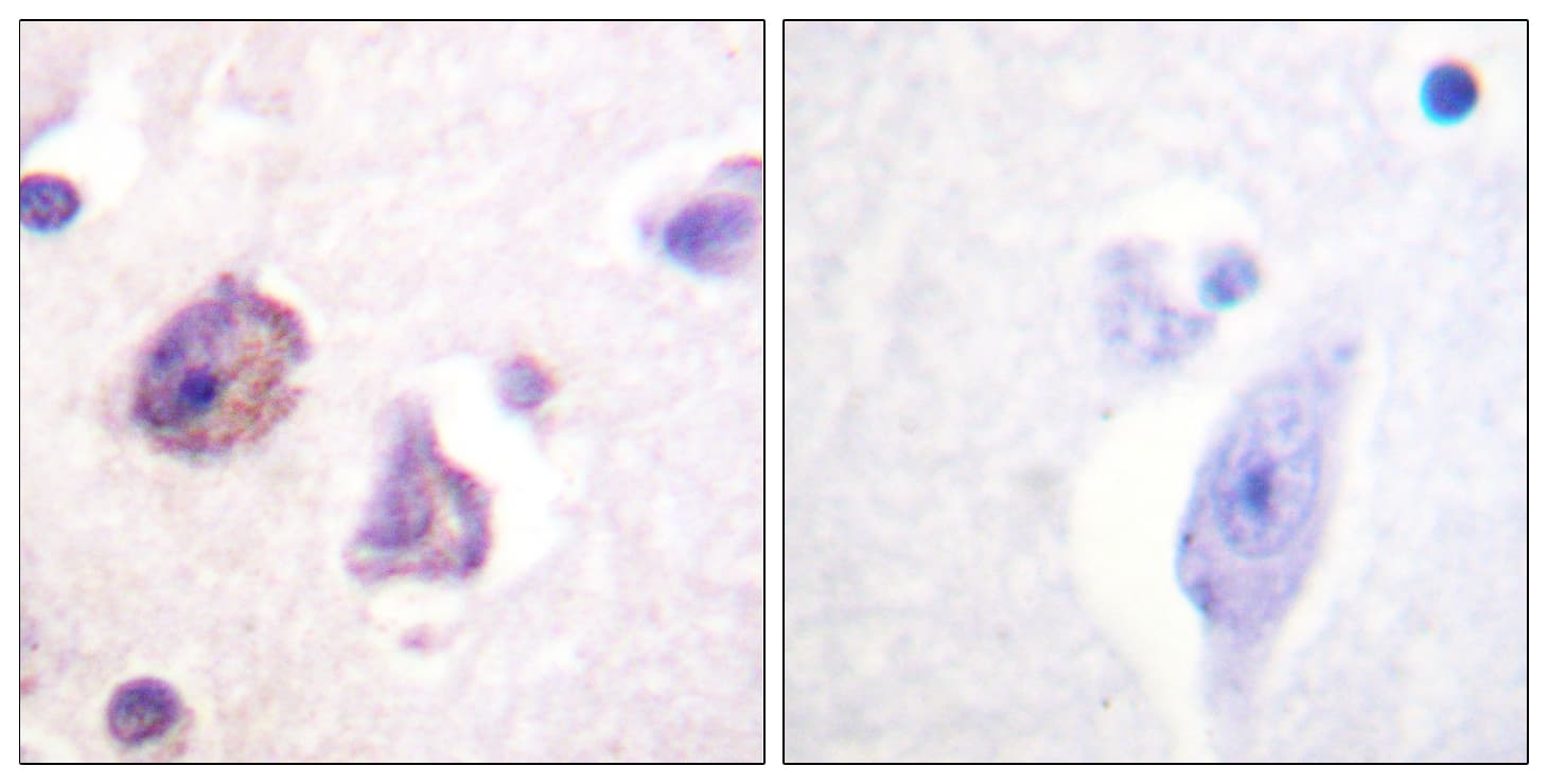 FAK / Focal Adhesion Kinase Antibody (phospho-Tyr576)